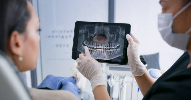 Licensed Teeth Whitening service in Bertram, TX - Smile Center Dentistry